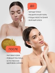 Adarisa / Выравнивающая и заживляющая маска для лица, 50 г . с гидролатом розы в подарок